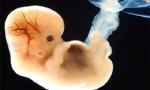 Pregnancy